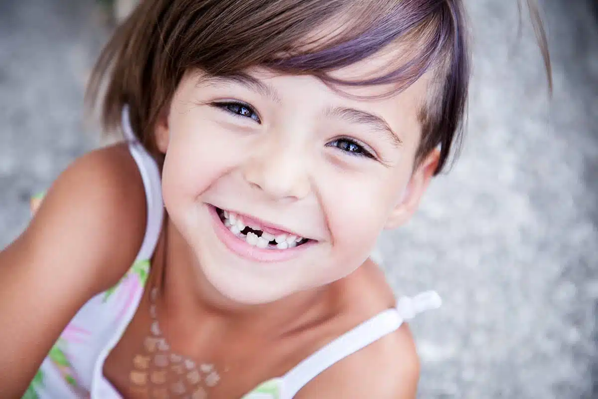 A child smiling showing her visible baby tooth in relation to pediatric tooth extractions.