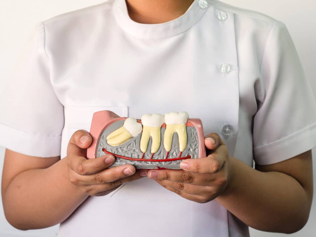 Depending on the angle of the impaction, the wisdom teeth can affect the gums or adjacent teeth.