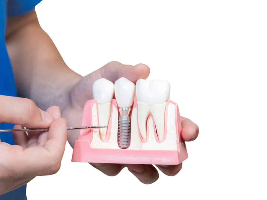 It is possible to replace a misaligned tooth with an implant. But first, a dental professional opinion is required.