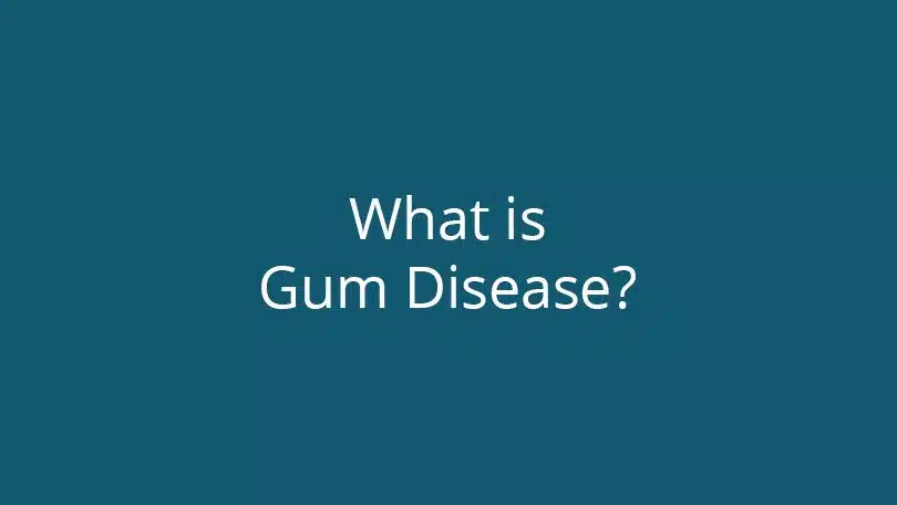 What is Gum Disease?