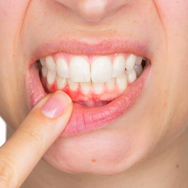 AlloDerm® is a revolutionary treatment that’s designed to reverse tissue loss