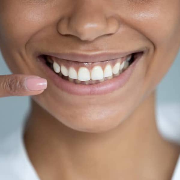 Between 10% and 25% of all adults are frustrated with the amount of gum line showing when they smile.