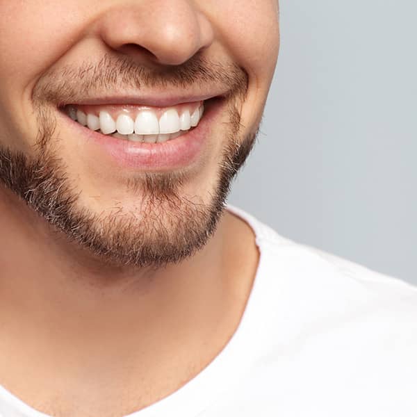 wanting to have white teeth? find out if you are a good candidate