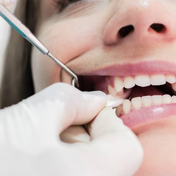 Immediately after a tooth is pulled, the patient should gently put pressure on the gauze placed on the extraction site. The bleeding should stop in about 45 minutes.