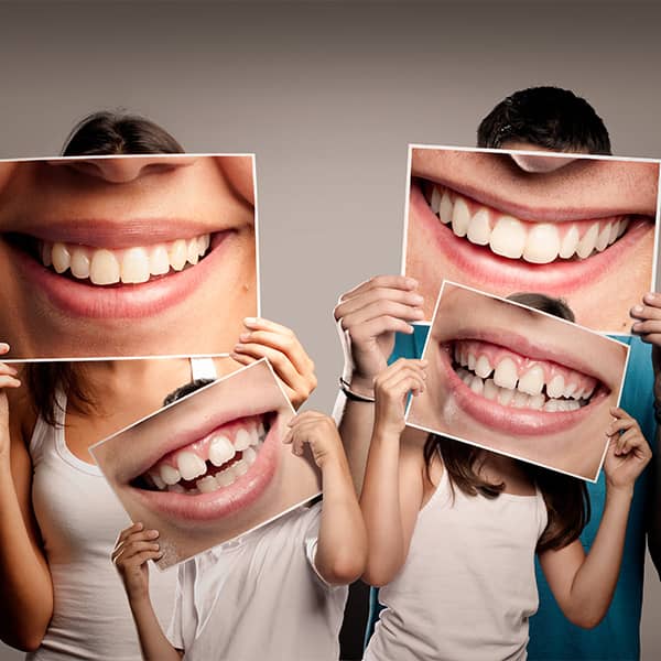 Candidates for AOO choose accelerated orthodontic treatment because they want to avoid wearing braces for extended periods of time, typically 1.5-3 years.