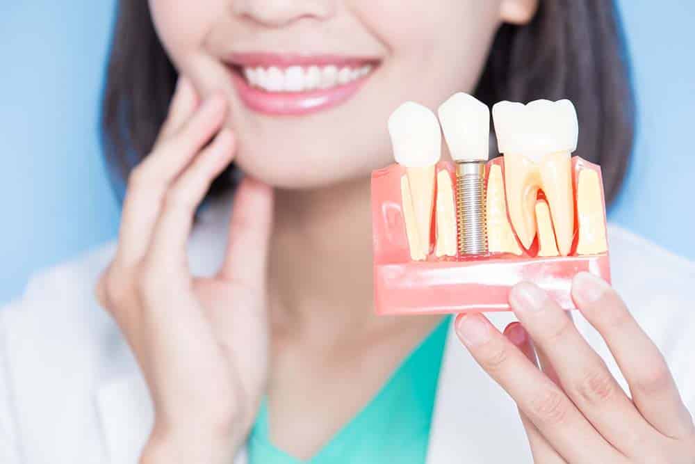 Full Arch dental Implants in Miami can be placed in one day, and the patient is able to eat immediately after the procedure