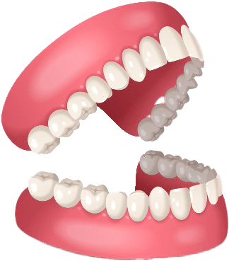 Benefits of Dentures