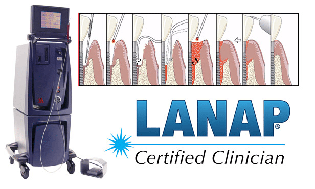 lanap certified clinician