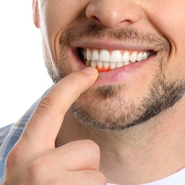 Periodontics Gallardo Miami