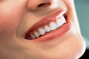 Gum graft surgeries can be improved with the use of Alloderm, a clinically proven, safe, and effective alternative to traditional gum grafts.