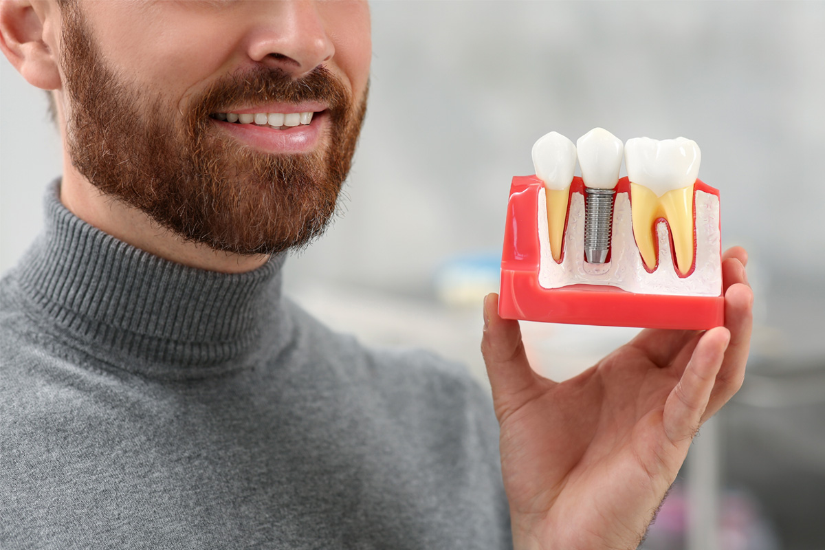 Benefits of Dental Bone Grafting Miami, FL
