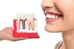 Same-day dental implant is a type of procedure that offers immediate results and an aesthetically pleasing solution for missing teeth.