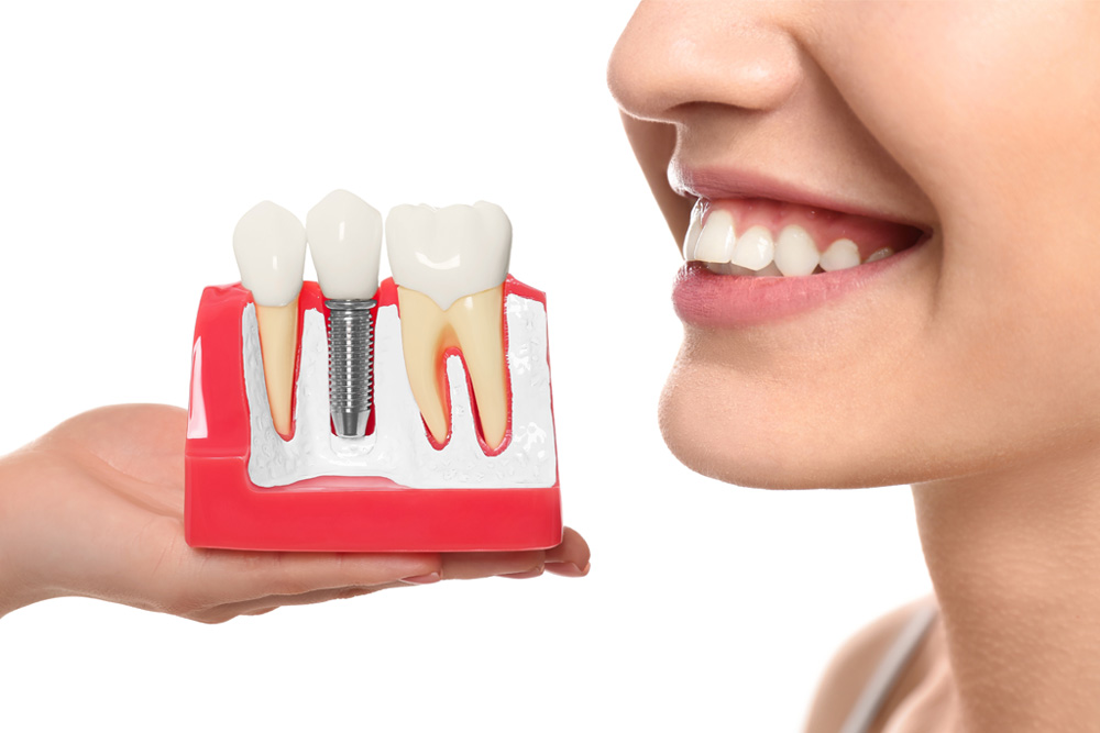 Same-day dental implant is a type of procedure that offers immediate results and an aesthetically pleasing solution for missing teeth.