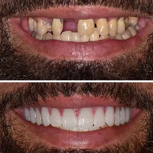 Periodontics & Dental Implants