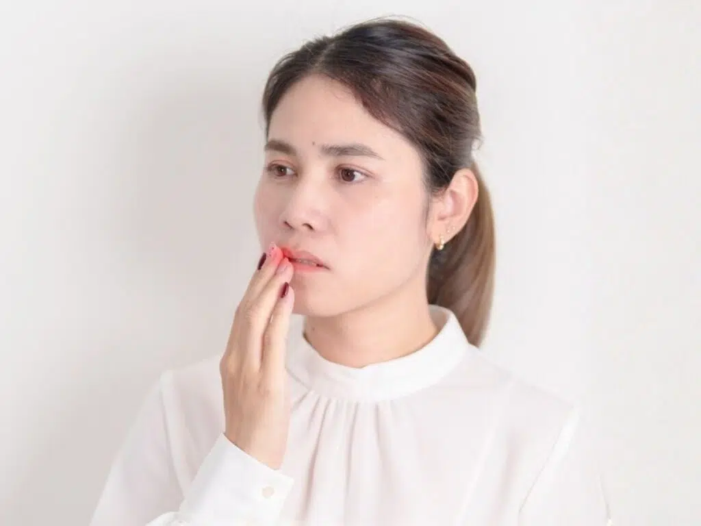 A woman in a white blouse looking concerned while touching her lip to indicate the painful area of a canker sore.