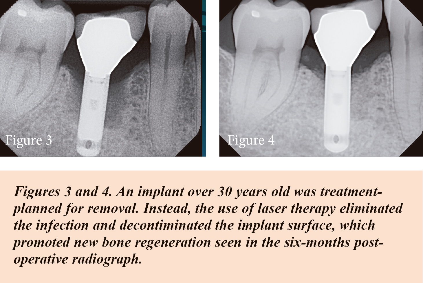 newsletter fig 3, 4