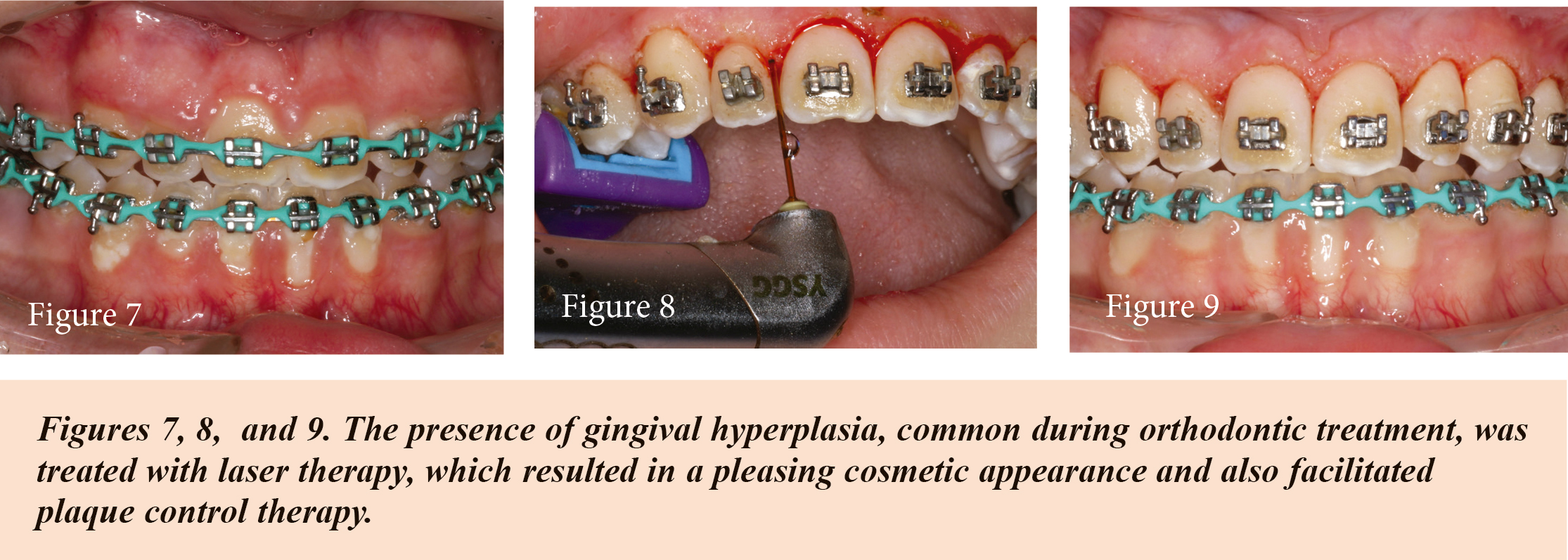newsletter fig 7, 8, 9