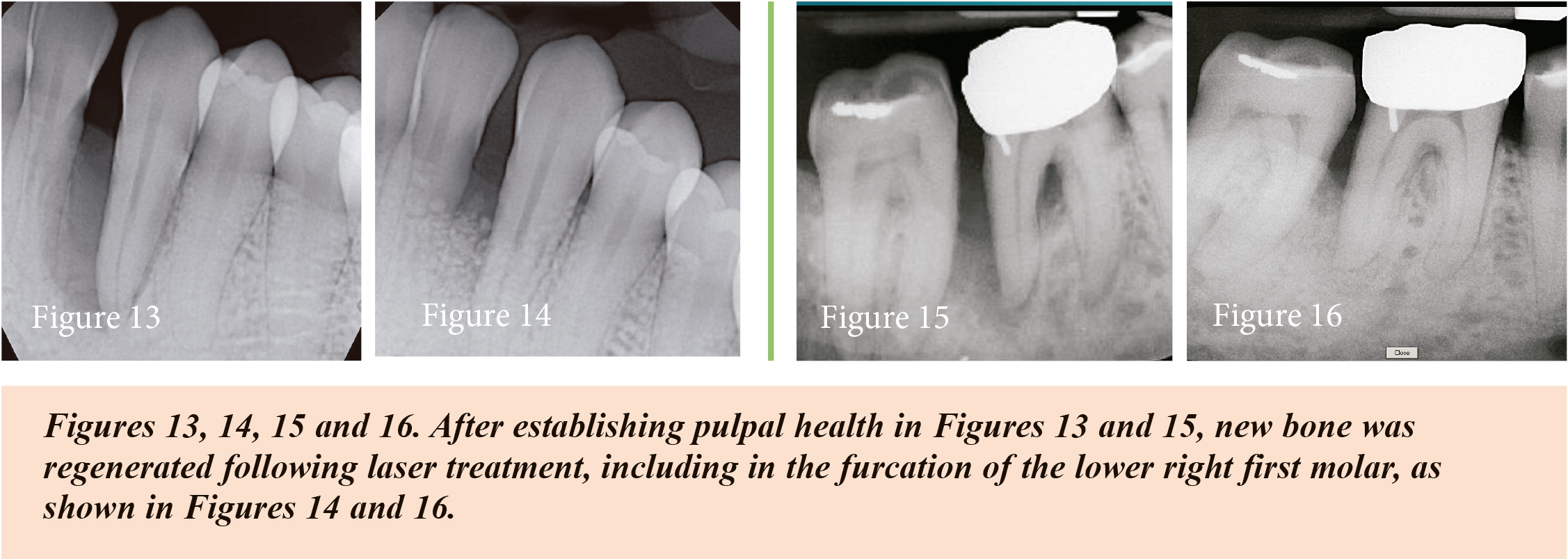 newsletter fig 13, 14, 15 and 16